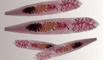 Opisthorchis parasite in human body