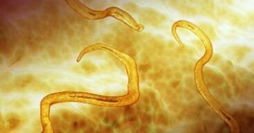 Pinworm parasite in human body