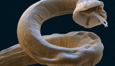 Roundworms parasitic in the human body