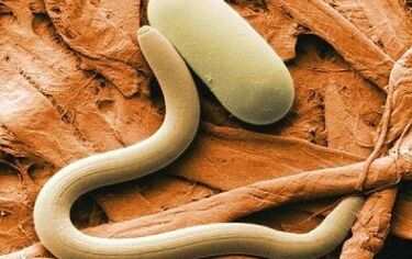Types of parasites humans are exposed to