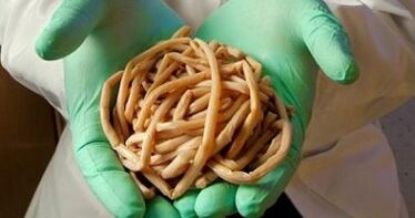 parasites extracted from human body