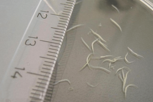 How to get rid of pinworms in your child