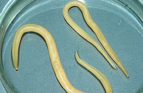 Roundworms in children