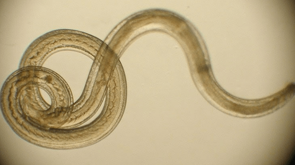 helminth parasites from the human body