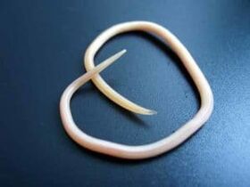 Human roundworm extracted from the human body