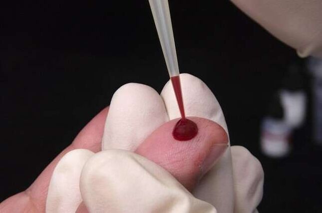 Draw blood for parasite analysis
