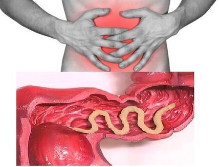 The sign of chronic helminthiasis is intestinal disease with indigestion