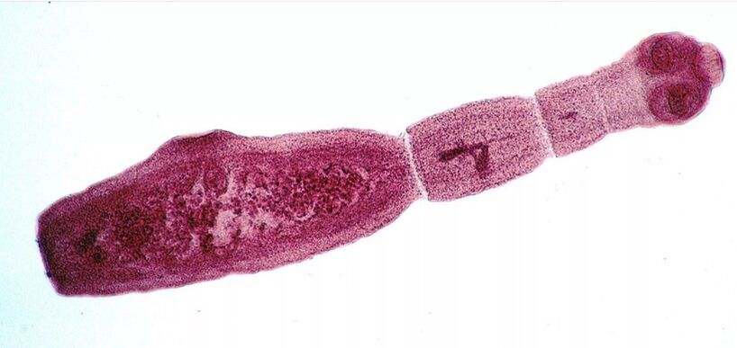 Echinococcus occidentalis is one of the most dangerous parasites in humans