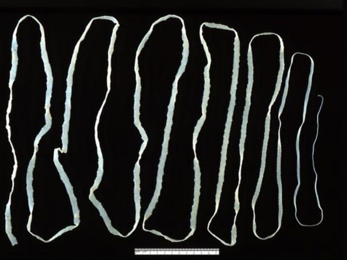 Cow tapeworm enters people through beef