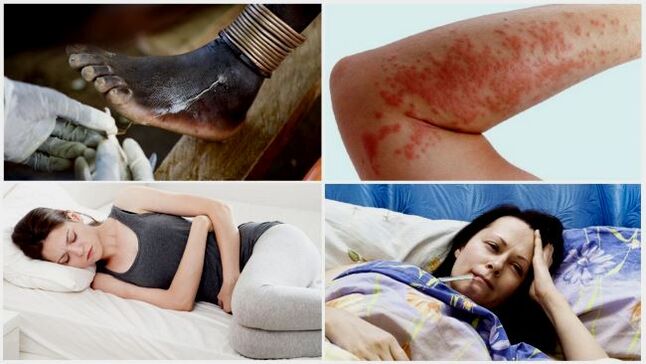 Common symptoms of subcutaneous parasitic infection