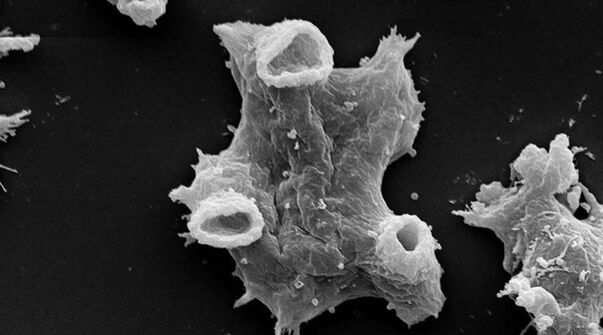 Negleria fowlera is a protozoan parasite that is harmful to human life. 