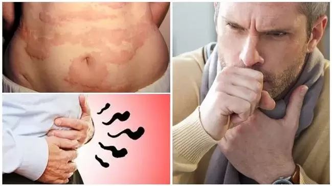 Allergies, coughs and bloating are signs of damage to the body from worms