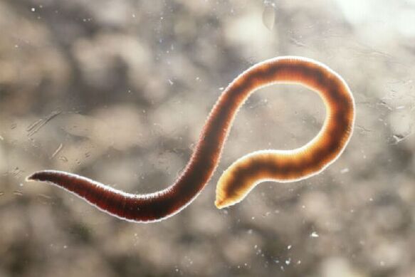 worms from humans
