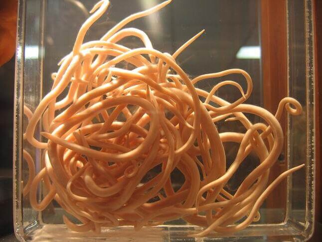 Roundworms are worms belonging to the class Nematoda. 