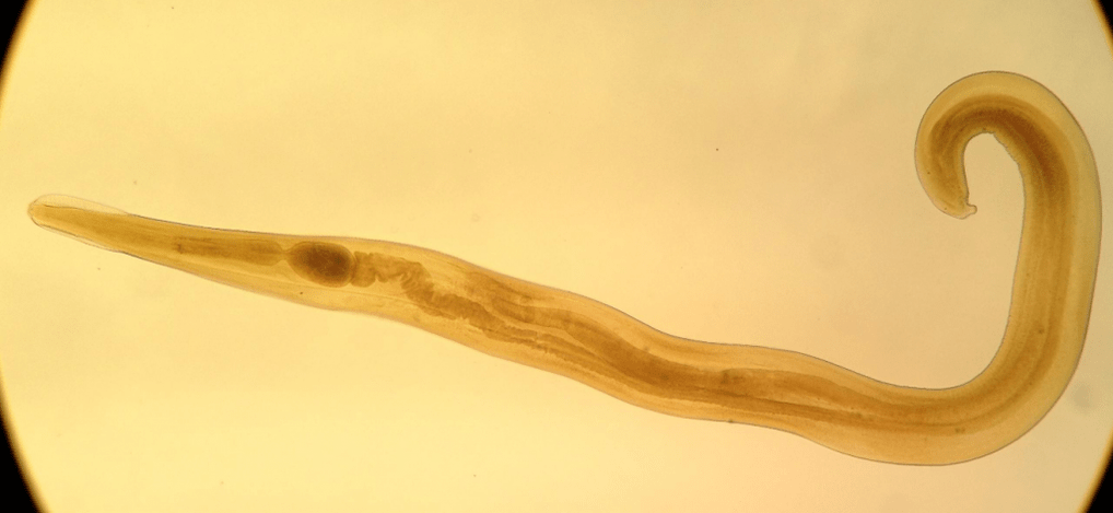 Pinworms are a common parasite among children. 