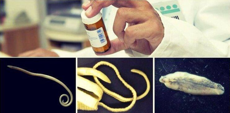 Types of worms and pharmaceutical methods to eliminate them